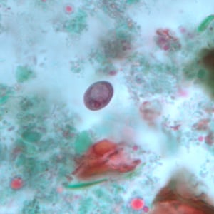 Case243_D.jpg