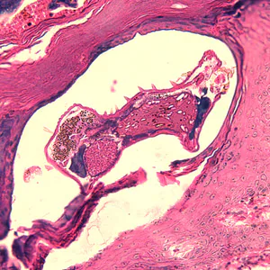 Case244_C.jpg