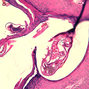 Case244_D.jpg