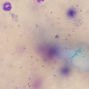 Case245_B.jpg