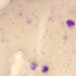 Case245_C.jpg