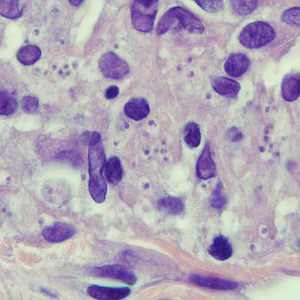 Case250_B.jpg