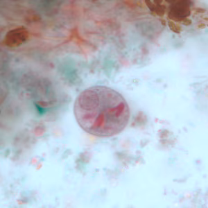 Case251_C.jpg