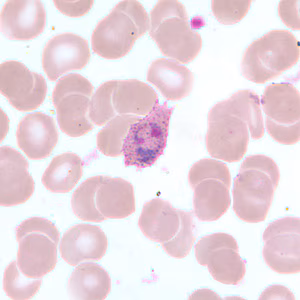 Case255_B.jpg