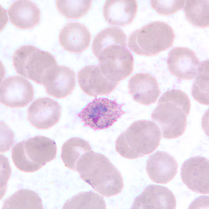 Case255_E.jpg