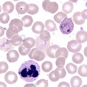 Case255_F.jpg
