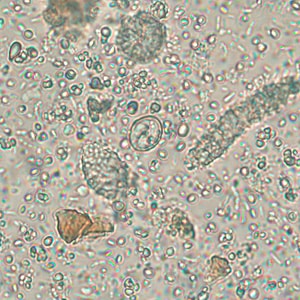 Case256_B.jpg