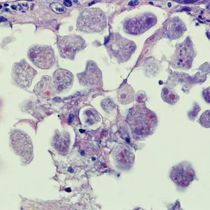 Case258_B.jpg