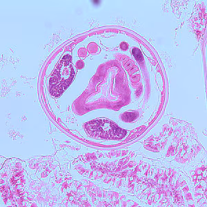 Case259_B.jpg