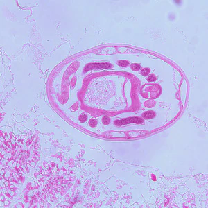 Case259_C.jpg