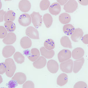 Case262_B.jpg