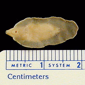 Case263_C.jpg