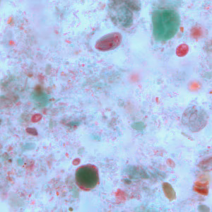 Case264_B.jpg