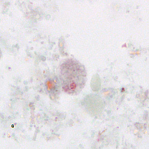 Case265_A.jpg