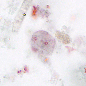 Case265_B.jpg