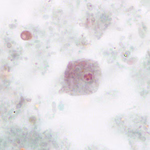 Case265_C.jpg