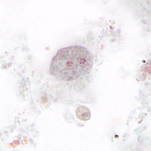 Case265_D.jpg