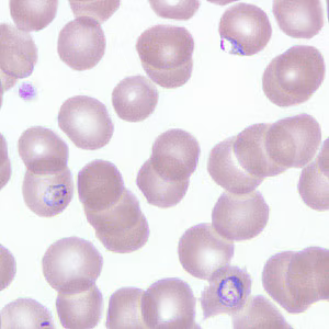 Case266_A.jpg