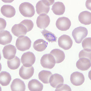 Case266_B.jpg