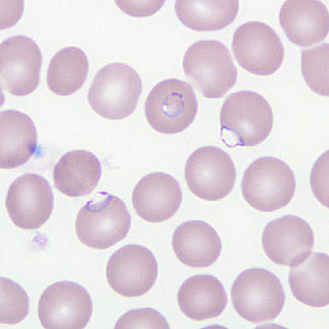 Case266_D.jpg