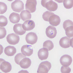 Case266_E.jpg