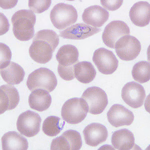 Case266_F.jpg