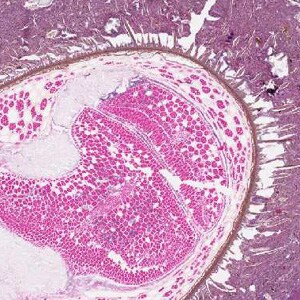Case267_C.jpg