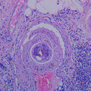 Case272_A.jpg
