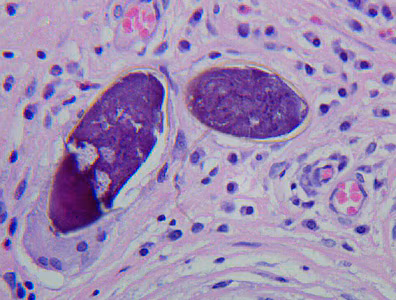 Case272_B.jpg