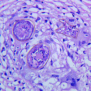 Case272_C.jpg