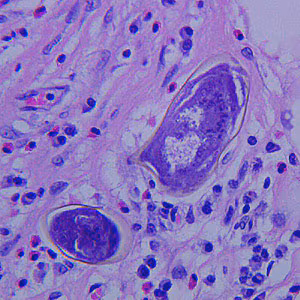 Case272_D.jpg