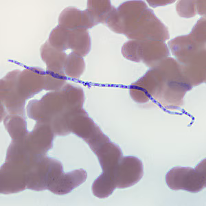 Case274_A.jpg