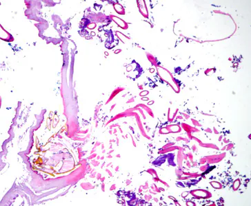Case275_A.jpg