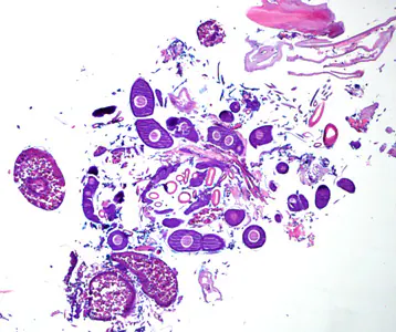 Case275_B.jpg