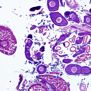 Case275_D.jpg
