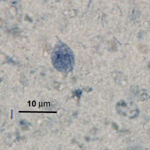 Case276_A.jpg