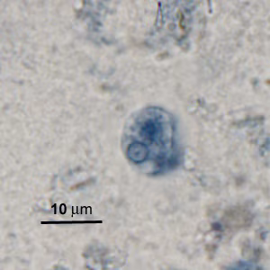 Case276_B.jpg