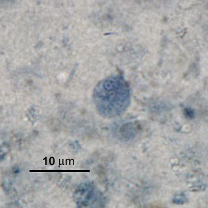 Case276_C.jpg