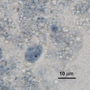 Case276_D.jpg
