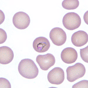 Case277_B.jpg
