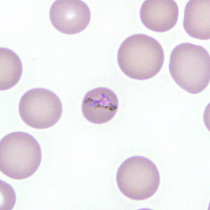 Case277_C.jpg