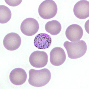 Case277_D.jpg