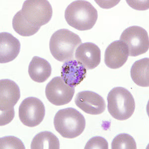 Case277_E.jpg