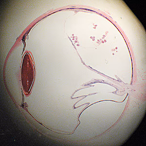 Case278_B.jpg