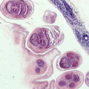 Case278_C.jpg