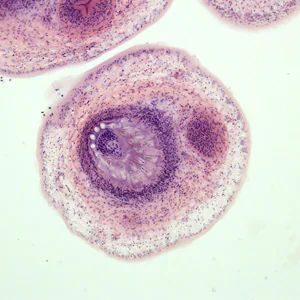 Case278_E.jpg