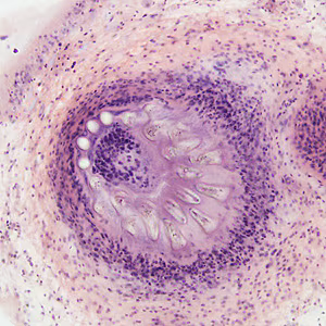 Case278_F.jpg