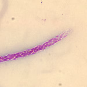 Case279_B.jpg