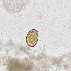 Case281_C.jpg Case281_C