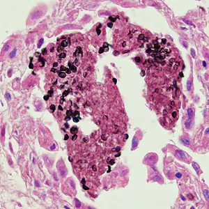 Case282_A.jpg